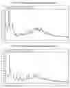 Fig. 09 - Amorphous and polymorphic forms of telmisartan sodium