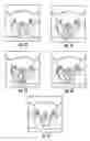 Fig. 08 - Surgical Introducer Apparatus and Methods of Use