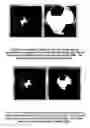 Fig. 03 - Methods and apparati for surgical navigation and visualization with microscope (