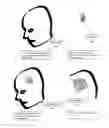 Fig. 05 - Methods and apparati for surgical navigation and visualization with microscope (