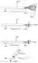 Fig. 09 - Minimally invasive surgical stabilization devices and methods