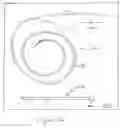 Fig. 15 - Minimally invasive surgical stabilization devices and methods