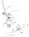 Fig. 17 - Minimally invasive surgical stabilization devices and methods