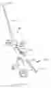 Fig. 19 - Minimally invasive surgical stabilization devices and methods