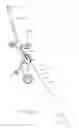 Fig. 20 - Minimally invasive surgical stabilization devices and methods