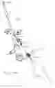 Fig. 22 - Minimally invasive surgical stabilization devices and methods