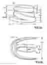 Fig. 09 - System and methods for intervertebral disc surgery