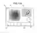 Fig. 14 - Endoscope with first and second imaging and illumination units