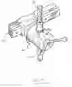Fig. 05 - Collapsible surgical tool bar