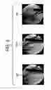 Fig. 06 - Method and system of acquiring images with a medical imaging device