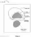 Fig. 05 - Method for automatic anatomy-specific treatment planning protocols based on historical integration of previously accepted plans