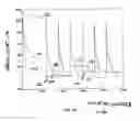 Fig. 10 - Nuclear magnetic resonance method for body composition analysis