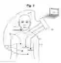 Fig. 02 - SCG point pick process device and method