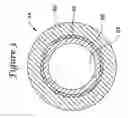 Fig. 04 - Apparatus and method for treating occluded vasculature