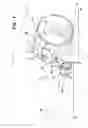 Fig. 02 - Orthopedic restraint and method for shoulder remediation
