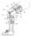 Fig. 01 - Orthopaedic brace having a range of motion hinge with an adjustable-length strut