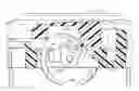 Fig. 01 - Applier for implantable medical device