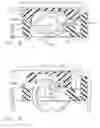 Fig. 08 - Applier for implantable medical device
