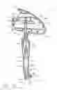 Fig. 16 - Applier for implantable medical device