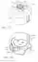 Fig. 19 - Applier for implantable medical device