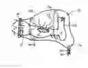Fig. 01 - Fluid containment apparatus for surgery and method of use