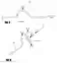 Fig. 07 - Methods and apparatus for introducing tumescent fluid to body tissue