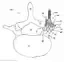 Fig. 01 - Orthopedic clamps