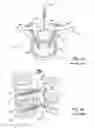 Fig. 03 - Orthopedic clamps