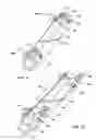 Fig. 07 - Orthopedic clamps