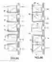 Fig. 05 - Connector for attaching an alignment rod to a bone structure