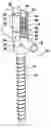Fig. 01 - Orthopaedic anchorage element and osteosynthesis device
