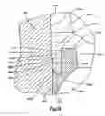 Fig. 13 - Apparatus for connecting a longitudinal member to a bone portion