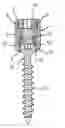 Fig. 01 - Receiving part for connecting a shank of a bone anchoring element to a rod and bone anchoring device with such a receiving part