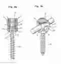 Fig. 03 - Receiving part for connecting a shank of a bone anchoring element to a rod and bone anchoring device with such a receiving part