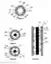Fig. 04 - Bone implant device and methods of using same