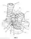 Fig. 09 - Bone screw locking mechanism and method of use