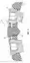Fig. 12 - Bone screw locking mechanism and method of use