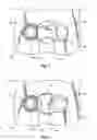 Fig. 03 - System and method for retaining screws relative to a vertebral plate