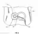 Fig. 06 - System and method for retaining screws relative to a vertebral plate