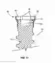Fig. 08 - System and method for retaining screws relative to a vertebral plate