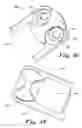 Fig. 07 - Surgical stabilization system