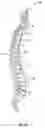 Fig. 02 - BONE COMPRESSION DEVICE