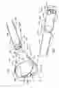 Fig. 04 - Method and apparatus for securing vertebrae