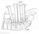 Fig. 01 - Orthopedic implant rod reduction tool set and method