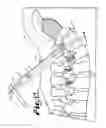 Fig. 05 - Orthopedic implant rod reduction tool set and method