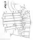 Fig. 06 - Orthopedic implant rod reduction tool set and method