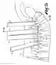 Fig. 08 - Orthopedic implant rod reduction tool set and method