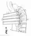 Fig. 11 - Orthopedic implant rod reduction tool set and method