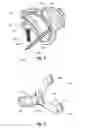 Fig. 05 - Milling system with guide paths and related methods for resecting a joint articulation surface