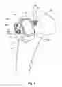 Fig. 06 - Milling system with guide paths and related methods for resecting a joint articulation surface
